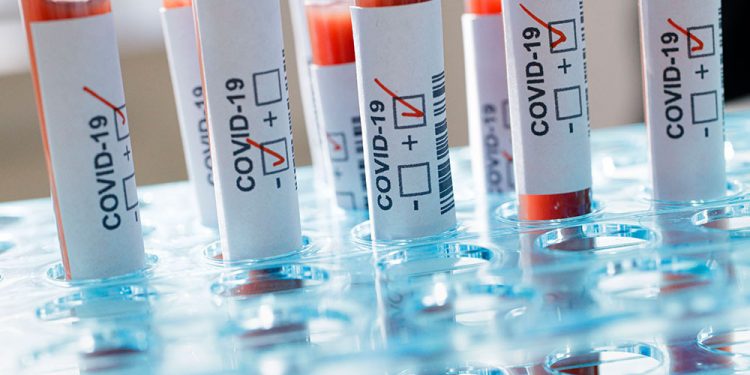 1176 test yapıldı, 16 kişiye PSR testi ile ileri tetkik yapılacak