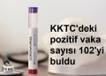 KKTC’deki pozitif vaka sayısı 102’yi buldu