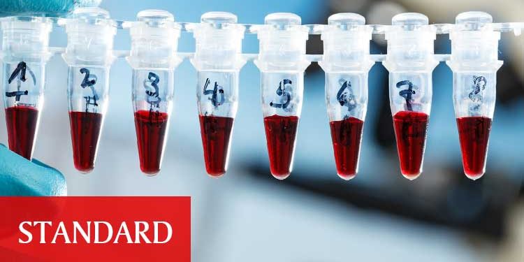 Covid-19’a yakalanma oranı daha az olan kan grupları açıklandı