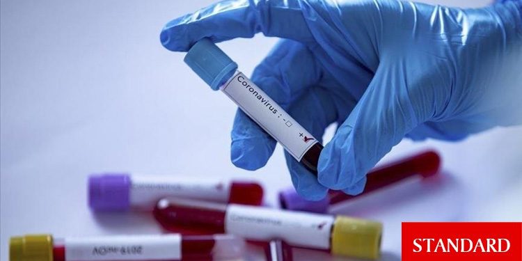 Belçika’da alarm! Test merkezlerinin kapasiteleri doldu