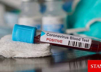 Türkiye’de aşısızlara test zorunluluğu kaldırıldı